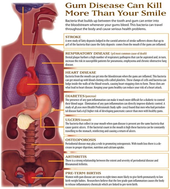 Gum disease impacts the entire body, not just the mouth