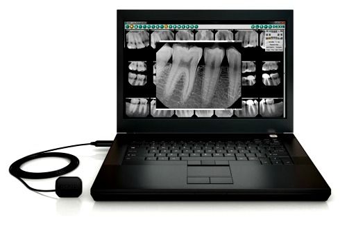 Digital dental x-rays Dentistry for the Entire Family Fridley MN