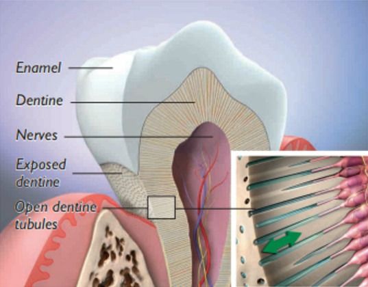 Exposed root surface causes teeth to become sensitive to hot and cold temperatures