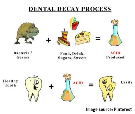 Healthy tooth plus acid can cause a cavity